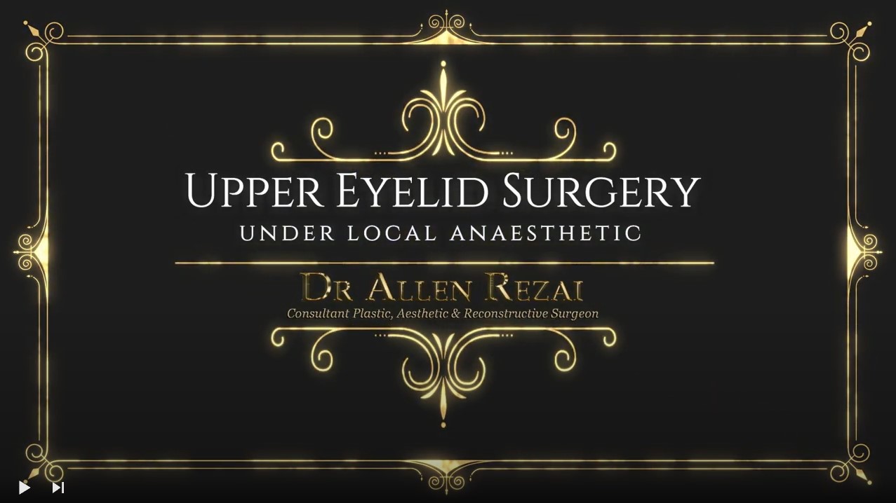 blepharoplasty